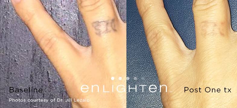  8 months old finger tattoos 1st pic right after touch swipe for healed  before touch up single needle  black  Instagram